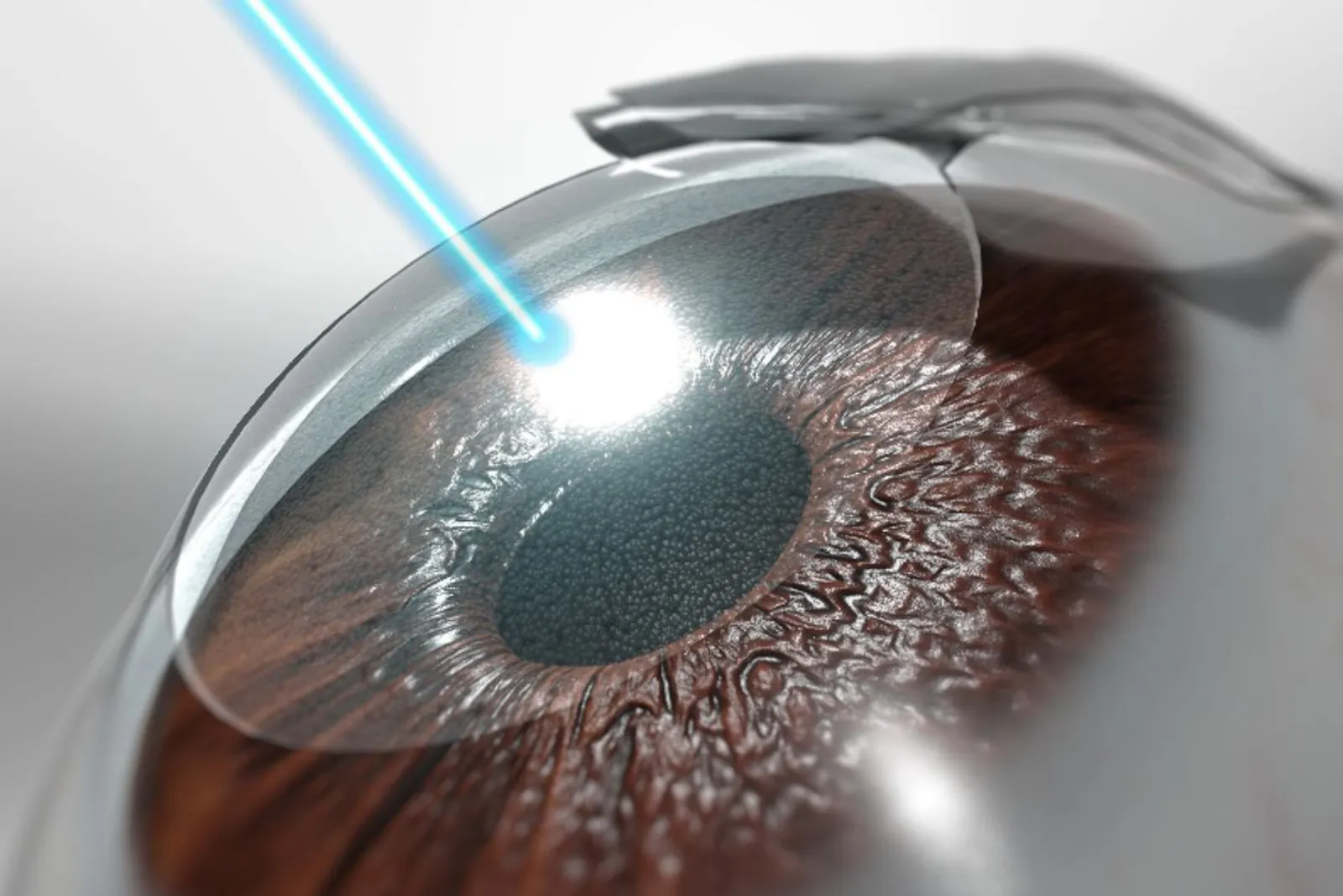 LASIK laser eye surgery at Sarojana Eye Hospital, Hasthinapuram, Hyderabad