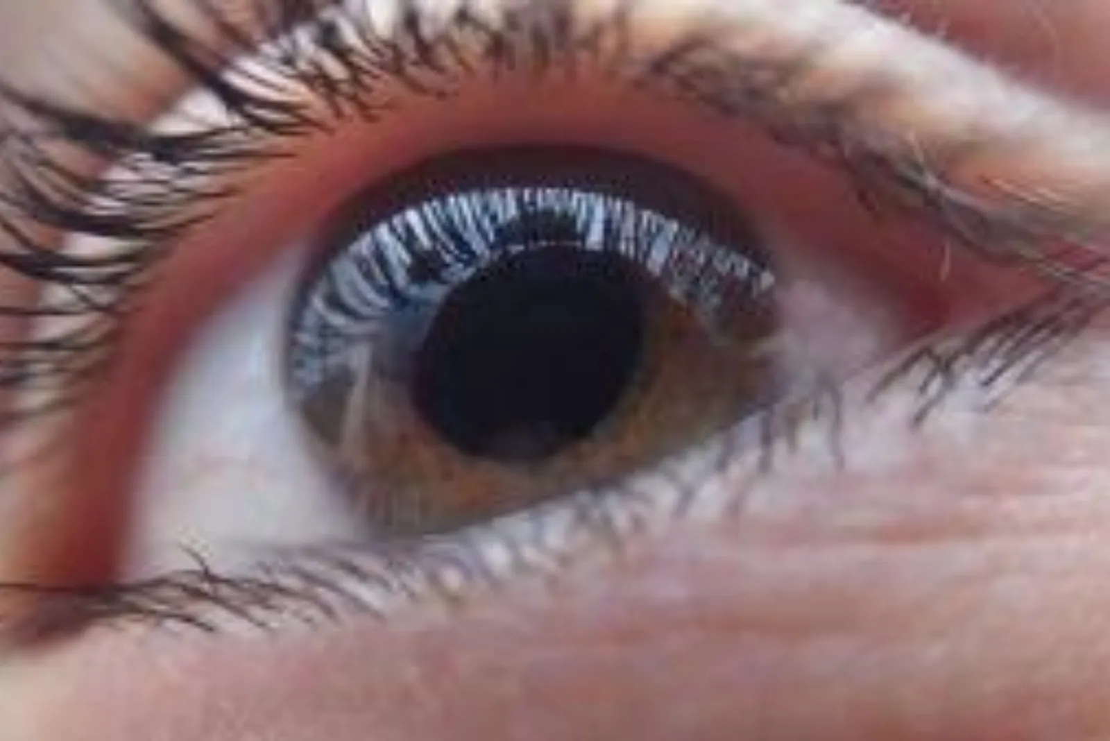Retina evaluation and advanced retinal imaging at Sarojana Eye Hospital, Hasthinapuram, Hyderabad