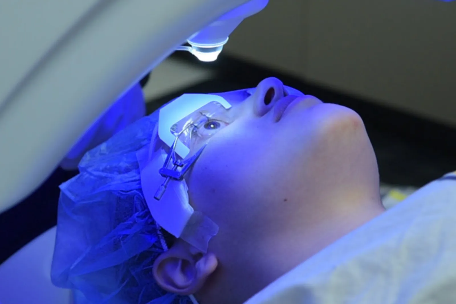 SMILE flapless laser vision correction at Sarojana Eye Hospital, Hasthinapuram, Hyderabad