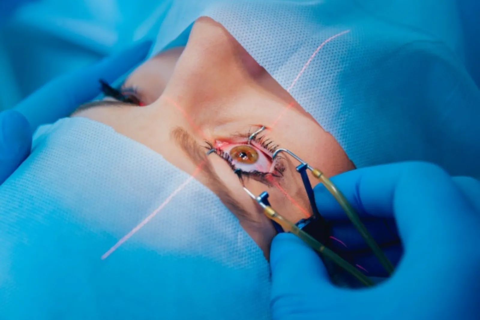 TRANS PRK flapless laser vision correction at Sarojana Eye Hospital, Hasthinapuram, Hyderabad